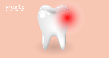 ホワイトニングの歯の痛み